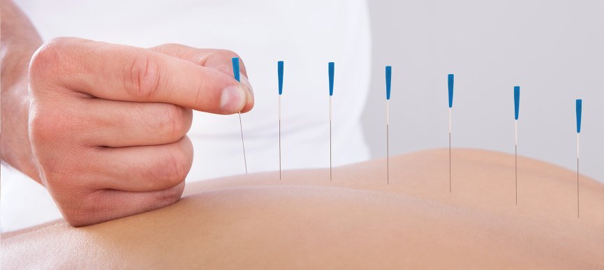 Akupunktur - Praxis für Orthopädie in Essen